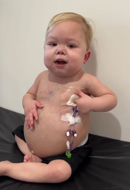 Kaleb showing his protected catheter